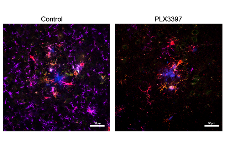 Breakthrough Discovery Links Brain Immune Cells to Alzheimer's Sleep Loss